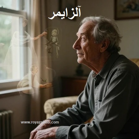 آلزایمر بیماری