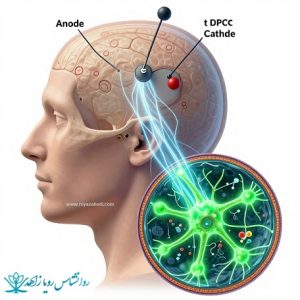 tdcs