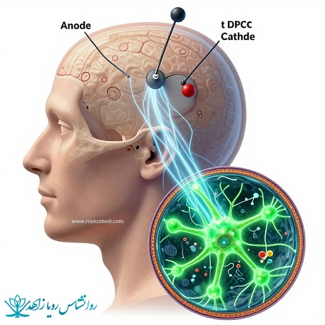 tdcs