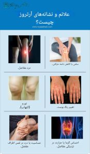 آرتروز و نوروساینس