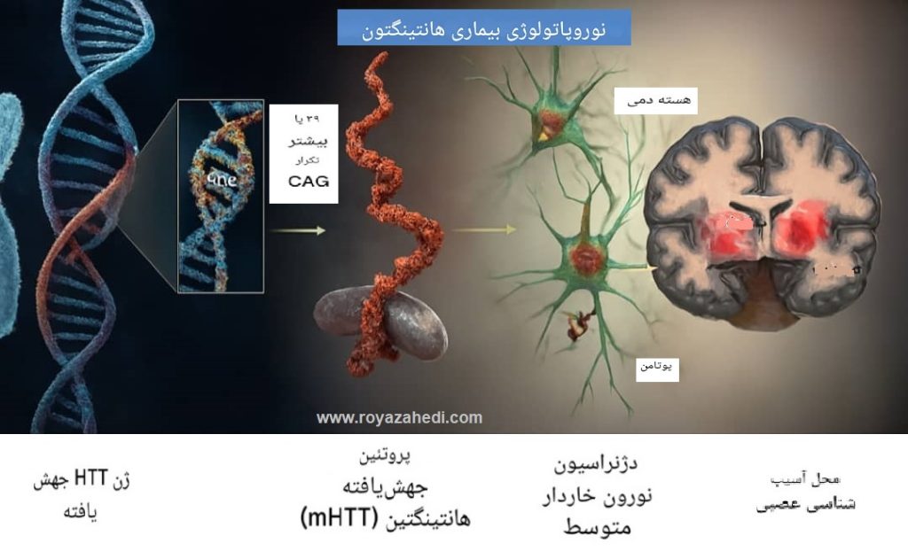 مسیر بیماری هانتینگتون