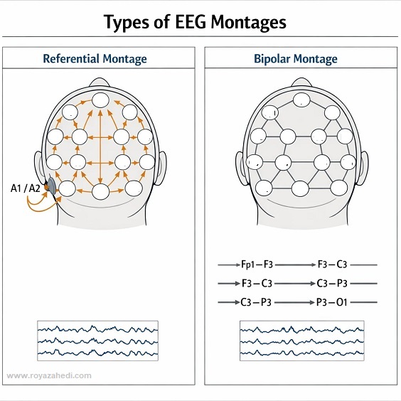 eeg انواع مونتاژ
