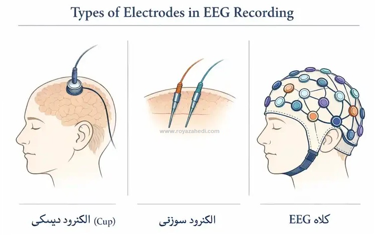 انواع الکترودها در ثبت EEG