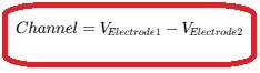 مونتاژ Referential در EEG